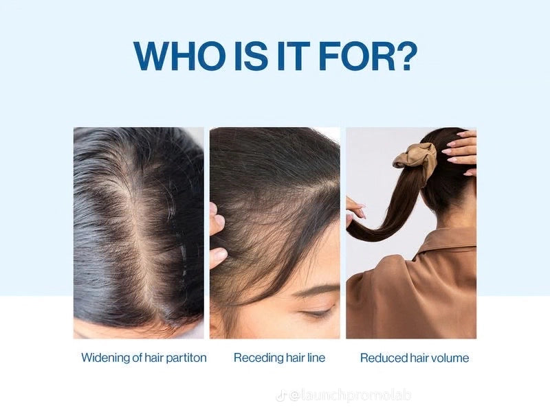 Be-Body.wide 3% Rosemary Hair Growth Serum – Stimulates Hair Regrowth, Strengthens Roots & Reduces Hair Fall (25 ml)